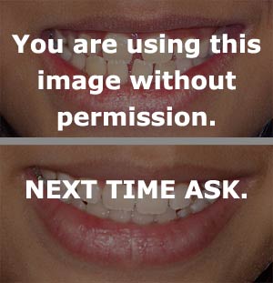 teeth_comparison.jpg